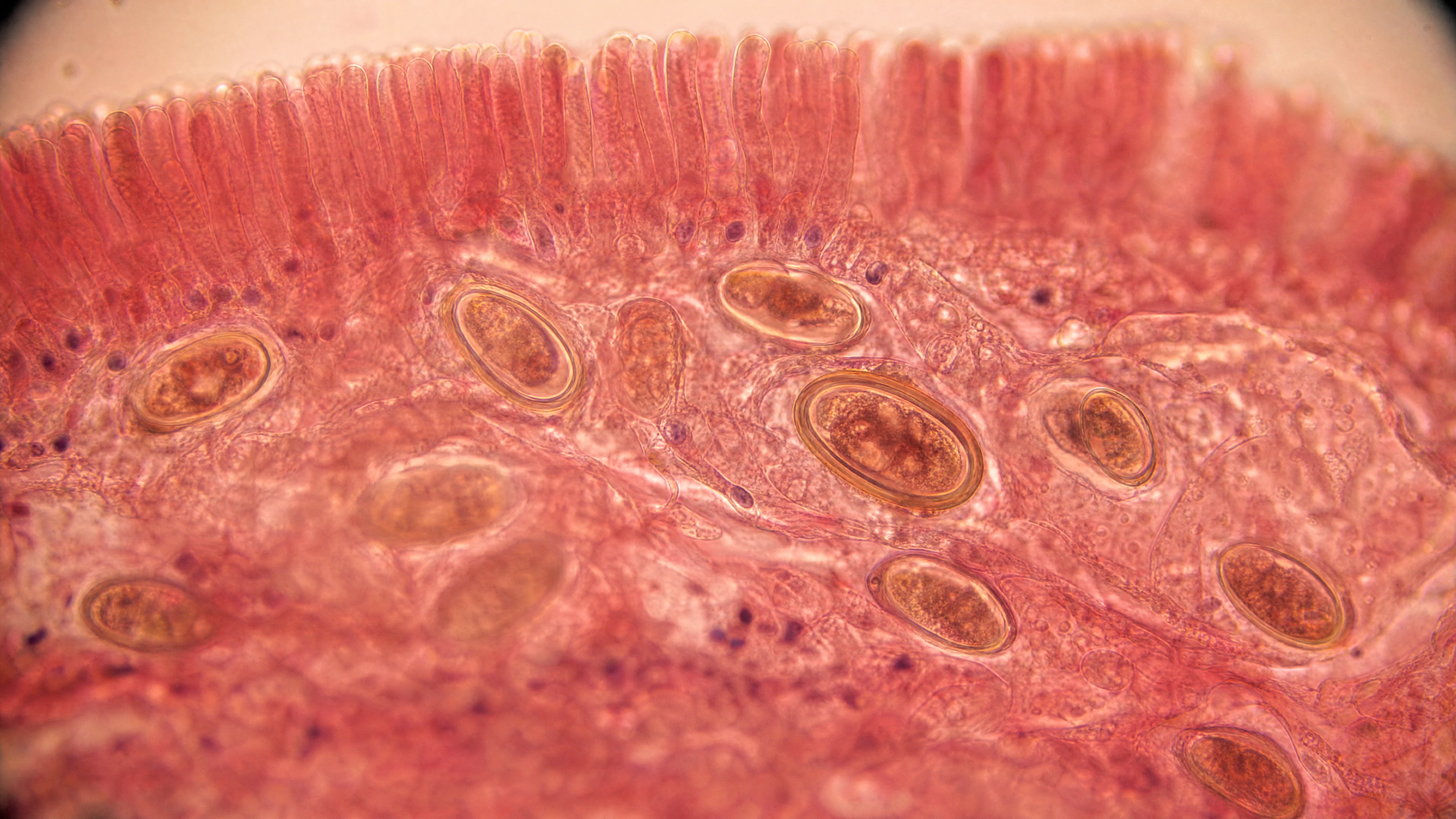 Mikroskopisch kleine Eier im Darmgewebe – die verborgene Stufe, die jede Kur übersieht