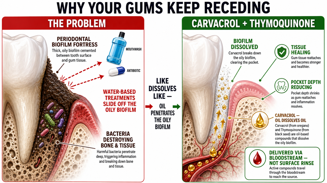 Why mouthwash cannot reach periodontal biofilm &mdash; the gum mechanism
