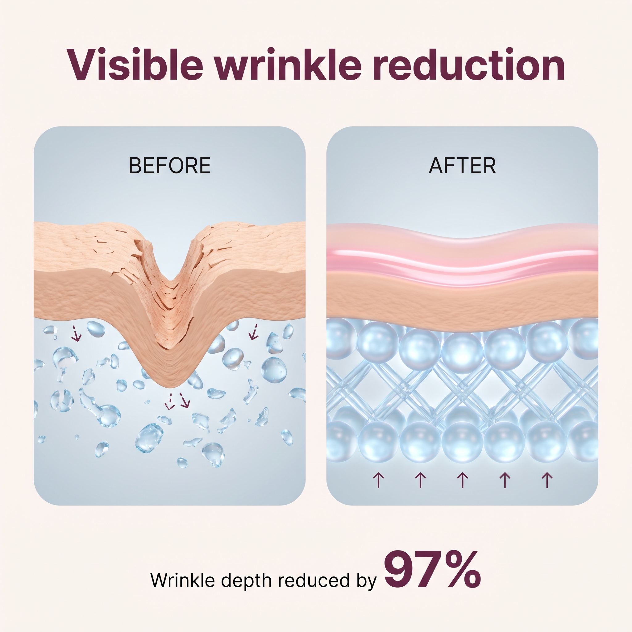 Visible wrinkle reduction infographic