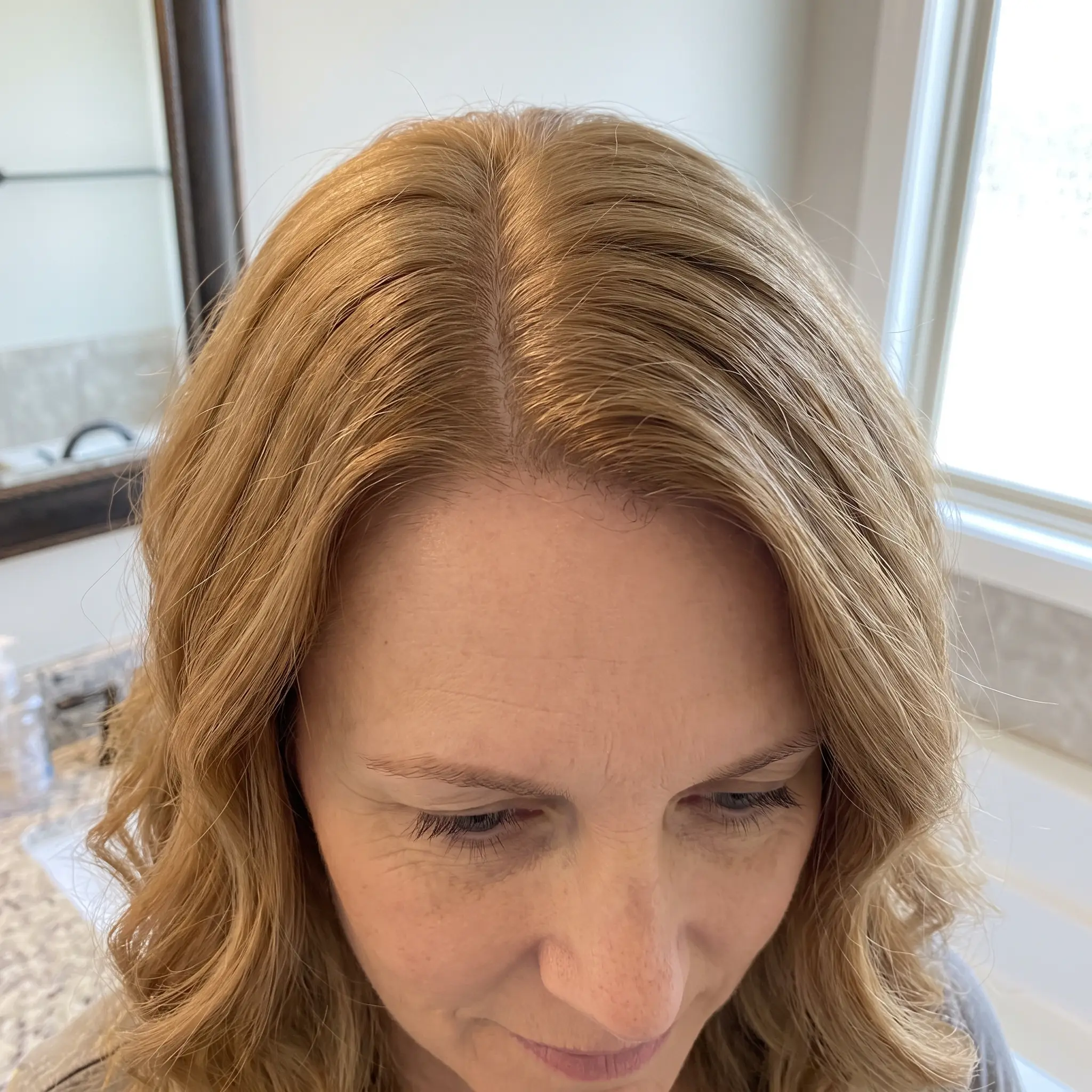 After: Hair Rich cosmetic coverage applied to the visible regrowth