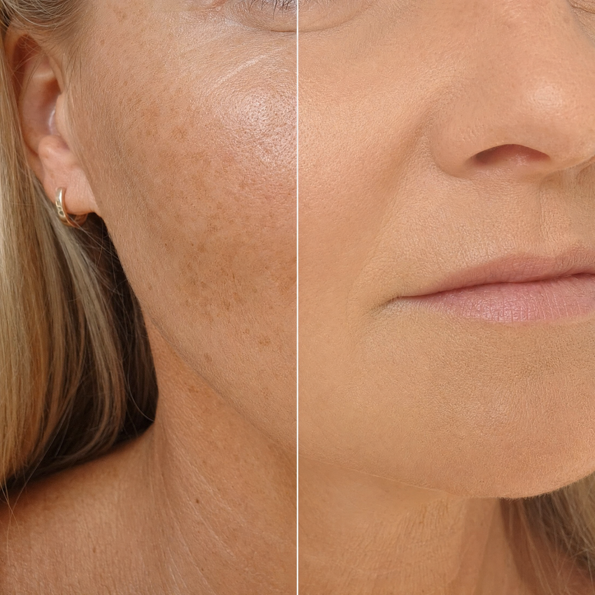 Coverage and SPF protection — before and after close-up
