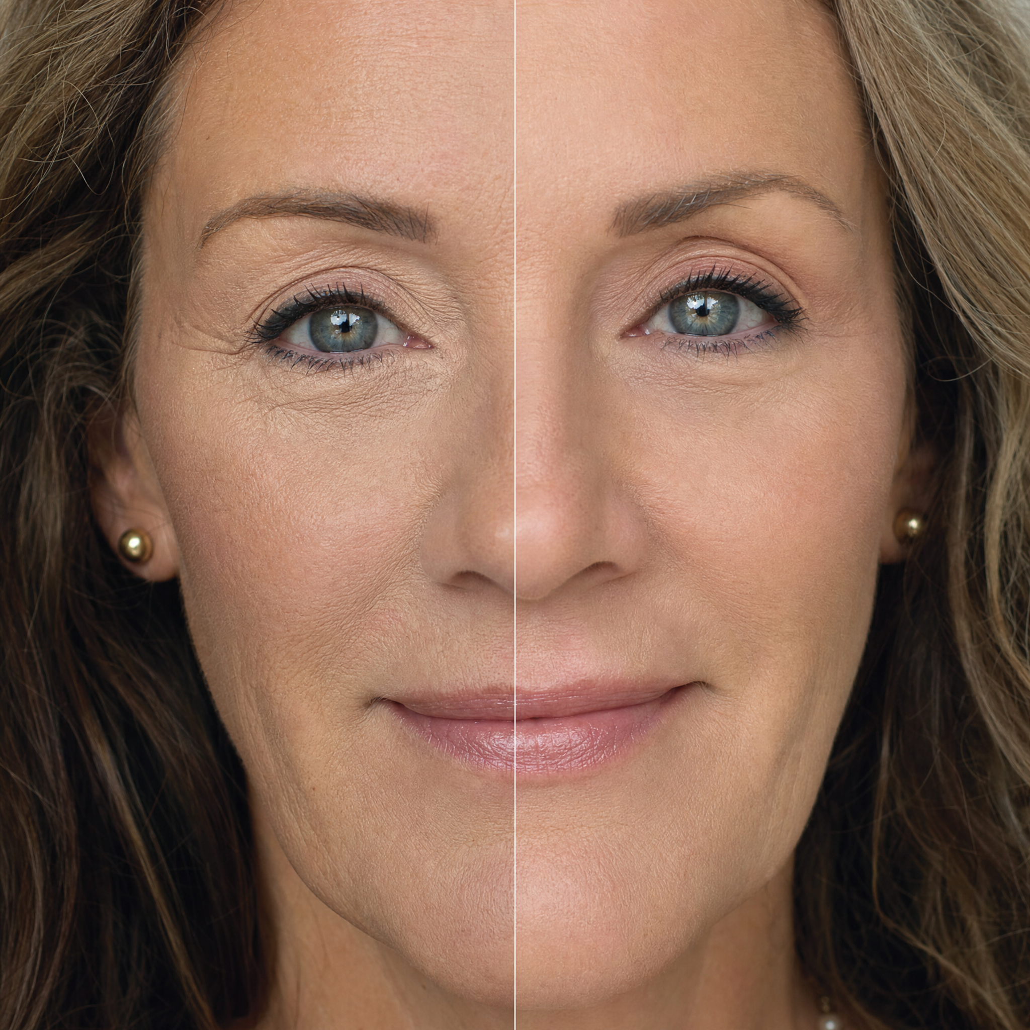 No creasing — fine lines before and after
