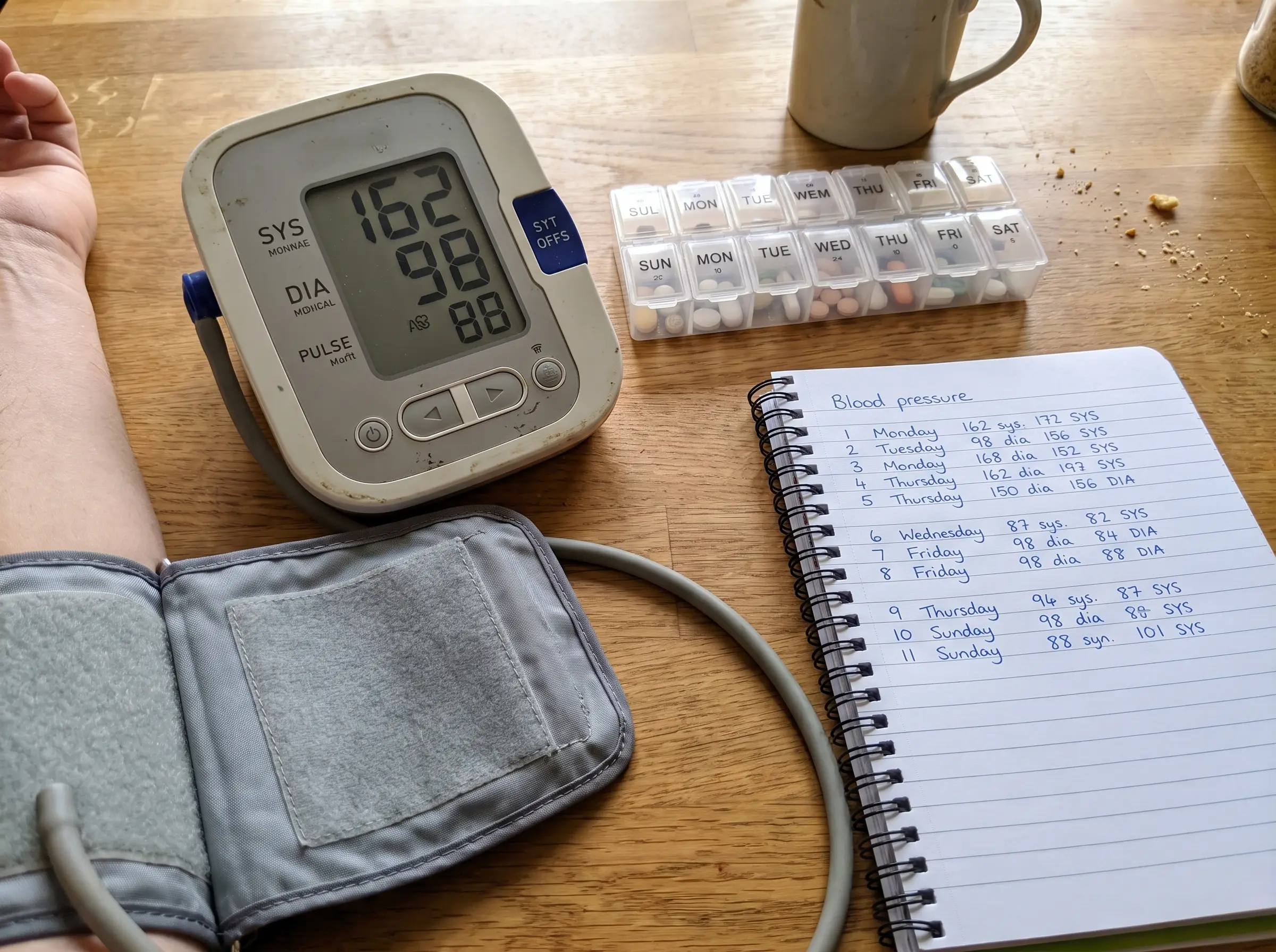 Real photo of living with high blood pressure