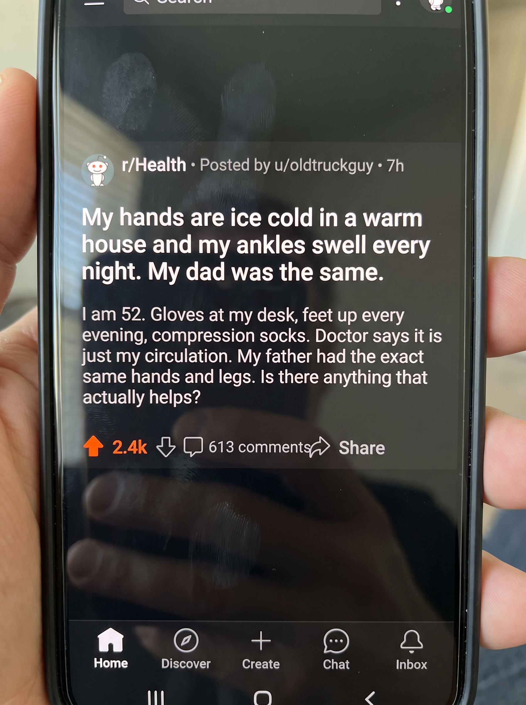 Reddit post: my hands are ice cold in a warm house and my ankles swell every night