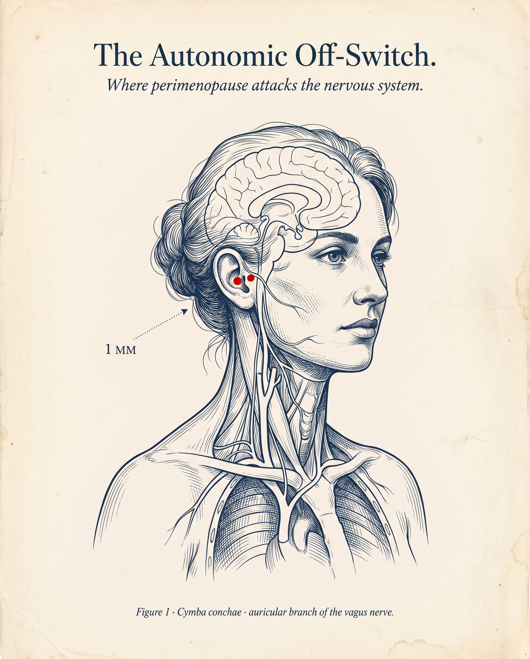 Anatomical illustration of the vagus nerve, with the auricular branch highlighted at the cymba conchae
