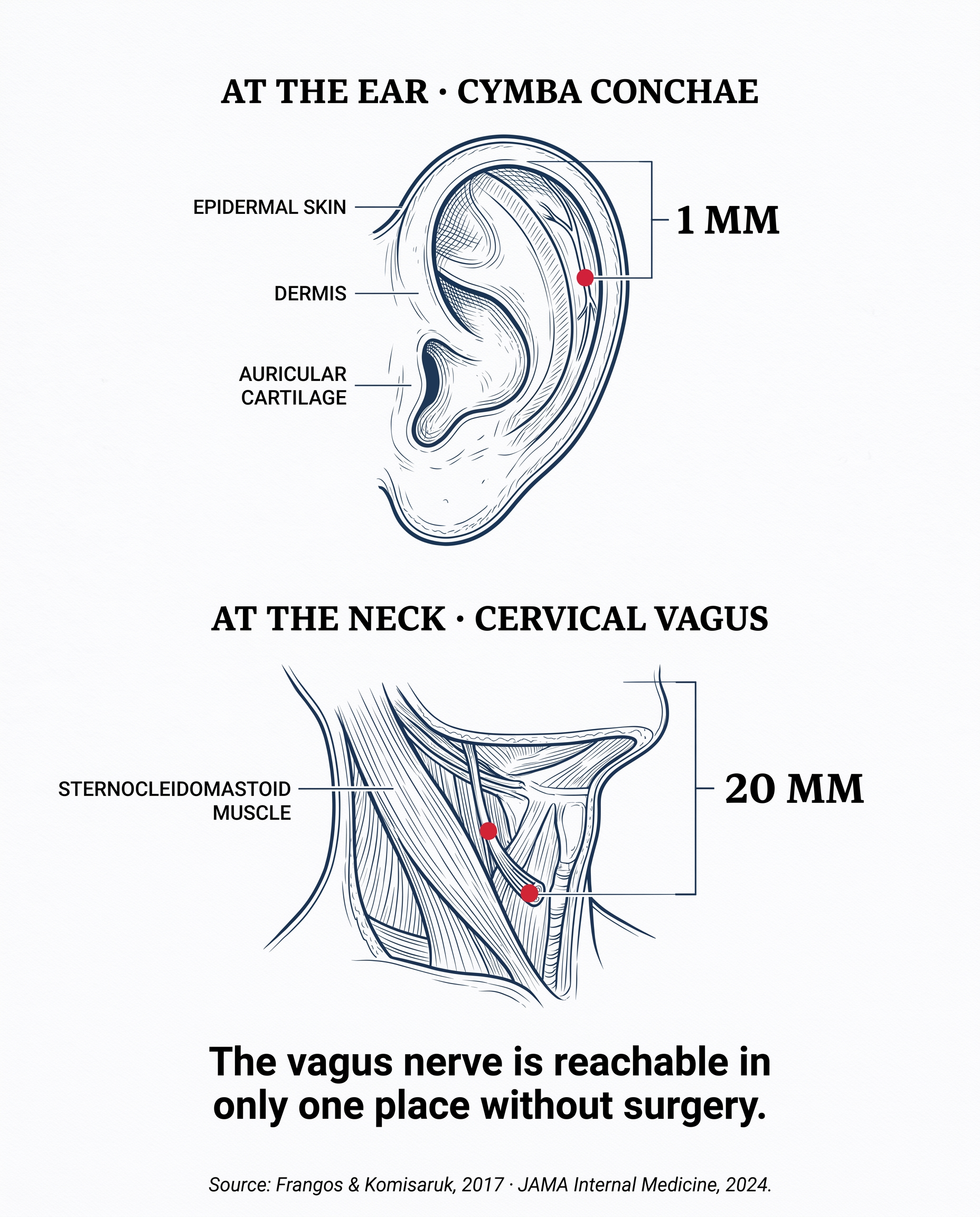 Anatomical infographic comparing the depth of the vagus nerve at the ear (1mm) vs at the neck (20mm)