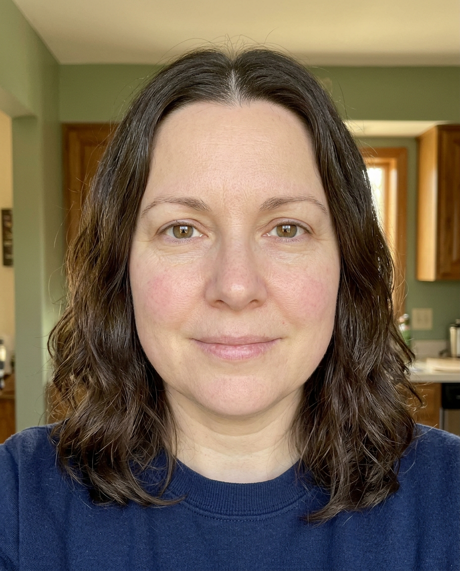 Mary at weeks 4-8 - redness significantly faded