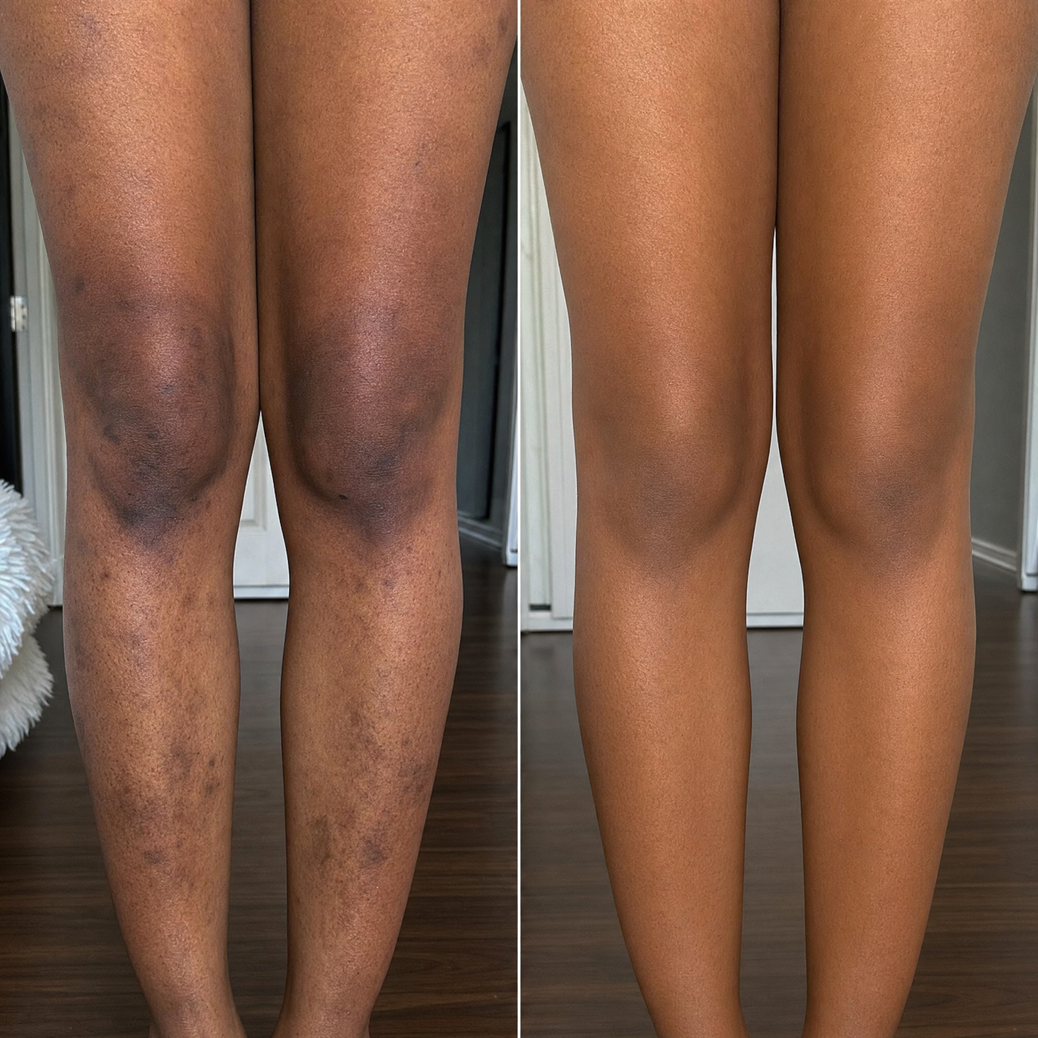 Dark spots before and after