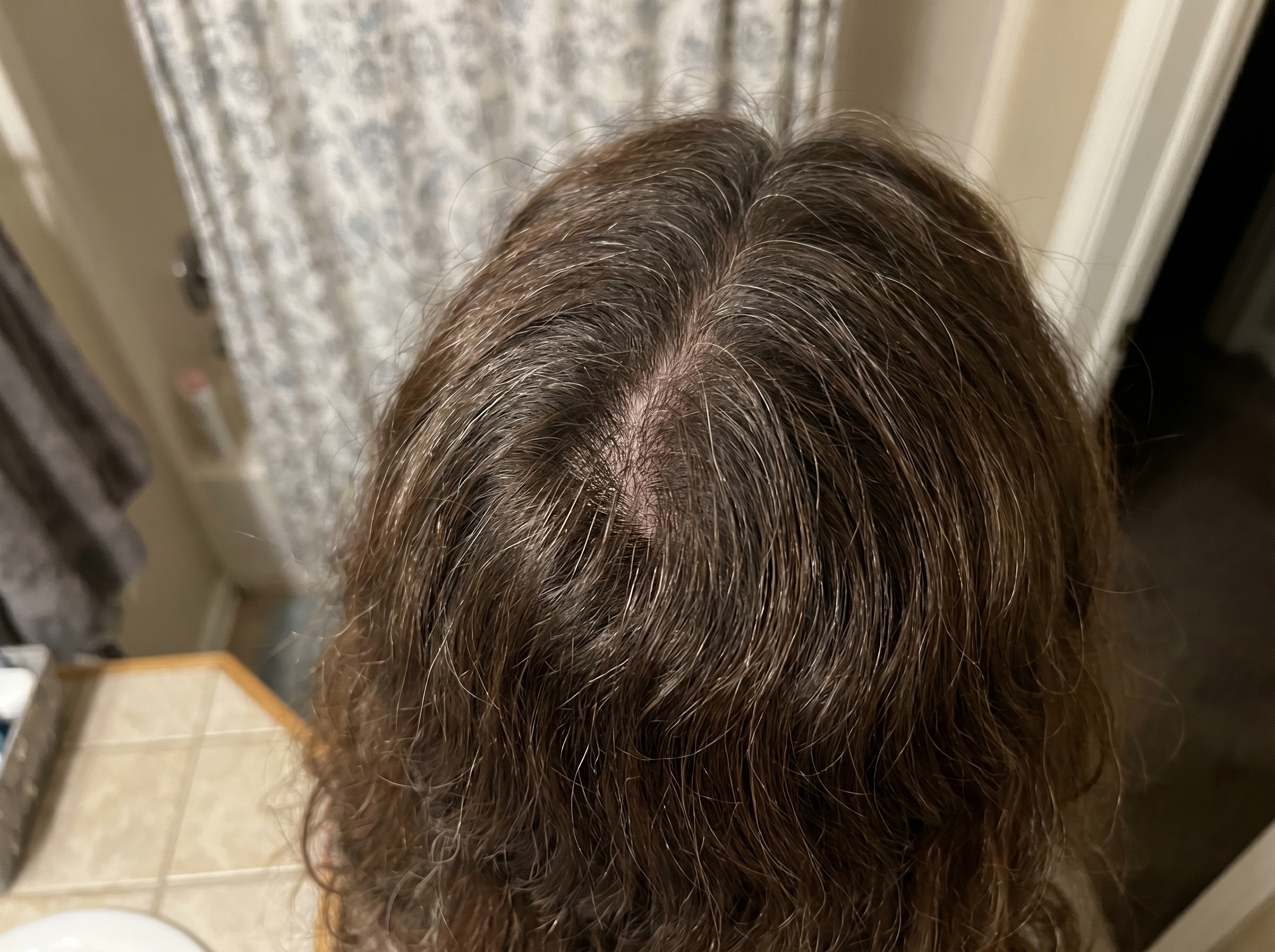 Scalp after two weeks