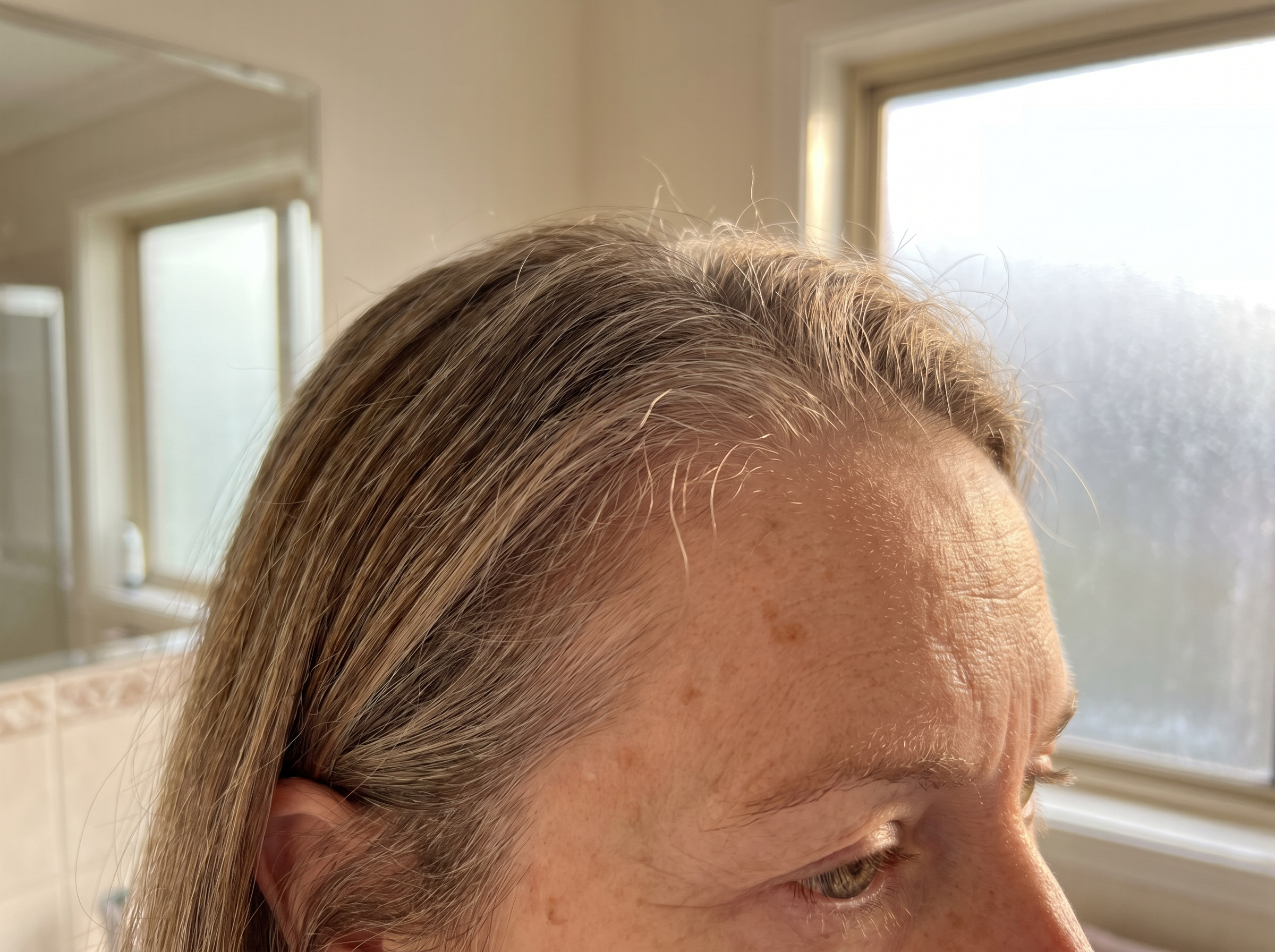New baby hairs along the hairline after one month