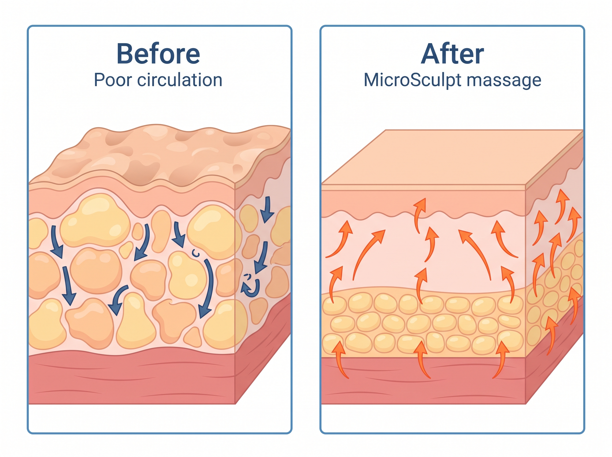 Before and after diagram: poor circulation vs MicroSculpt massage