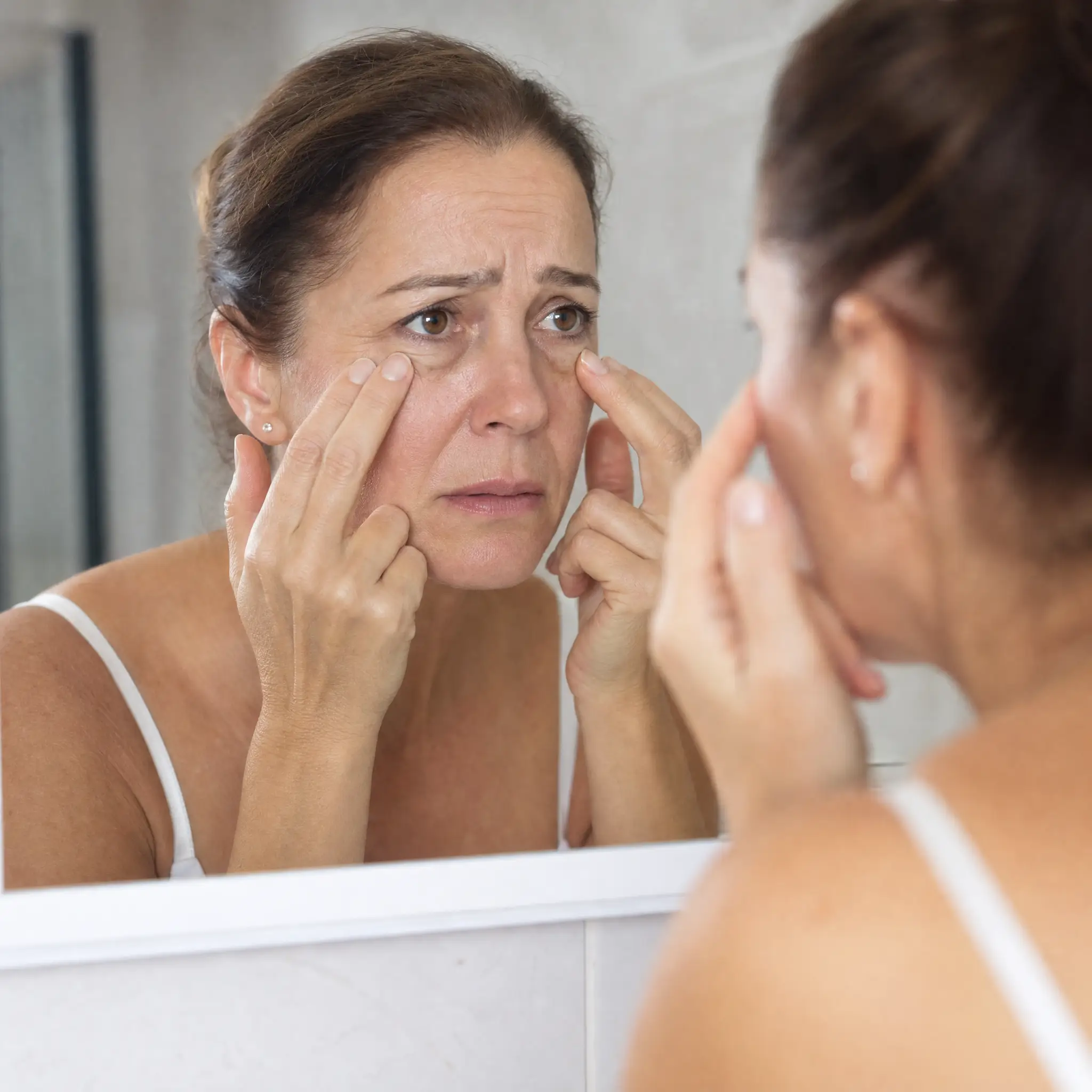 Woman concerned about under-eye aging