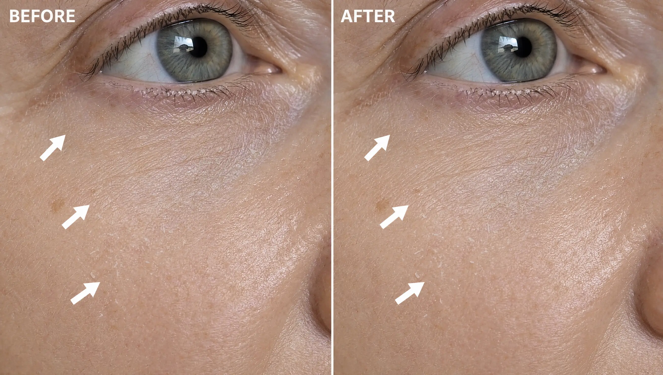 Hydration before and after
