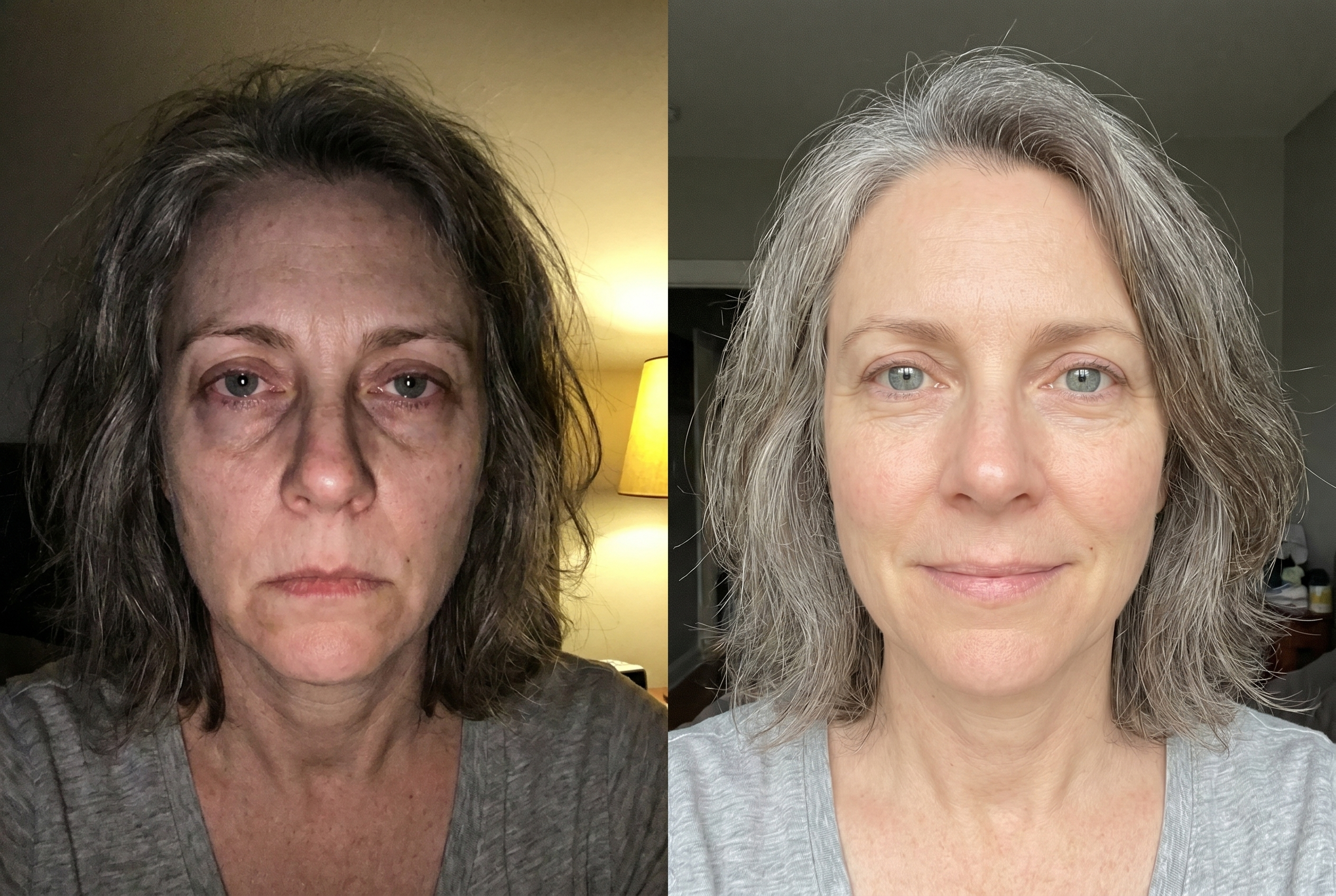 Same woman, before and after: a tired face and a well-rested face