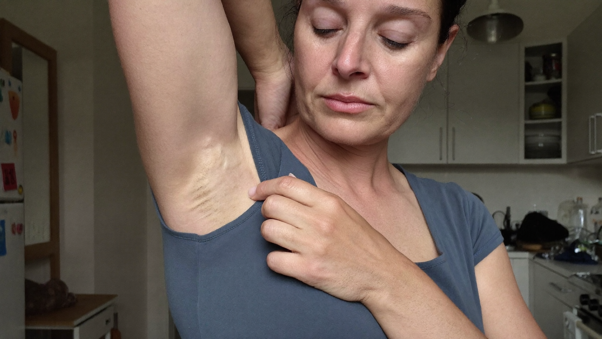 Vrouw voelt de losse huid aan haar bovenarm