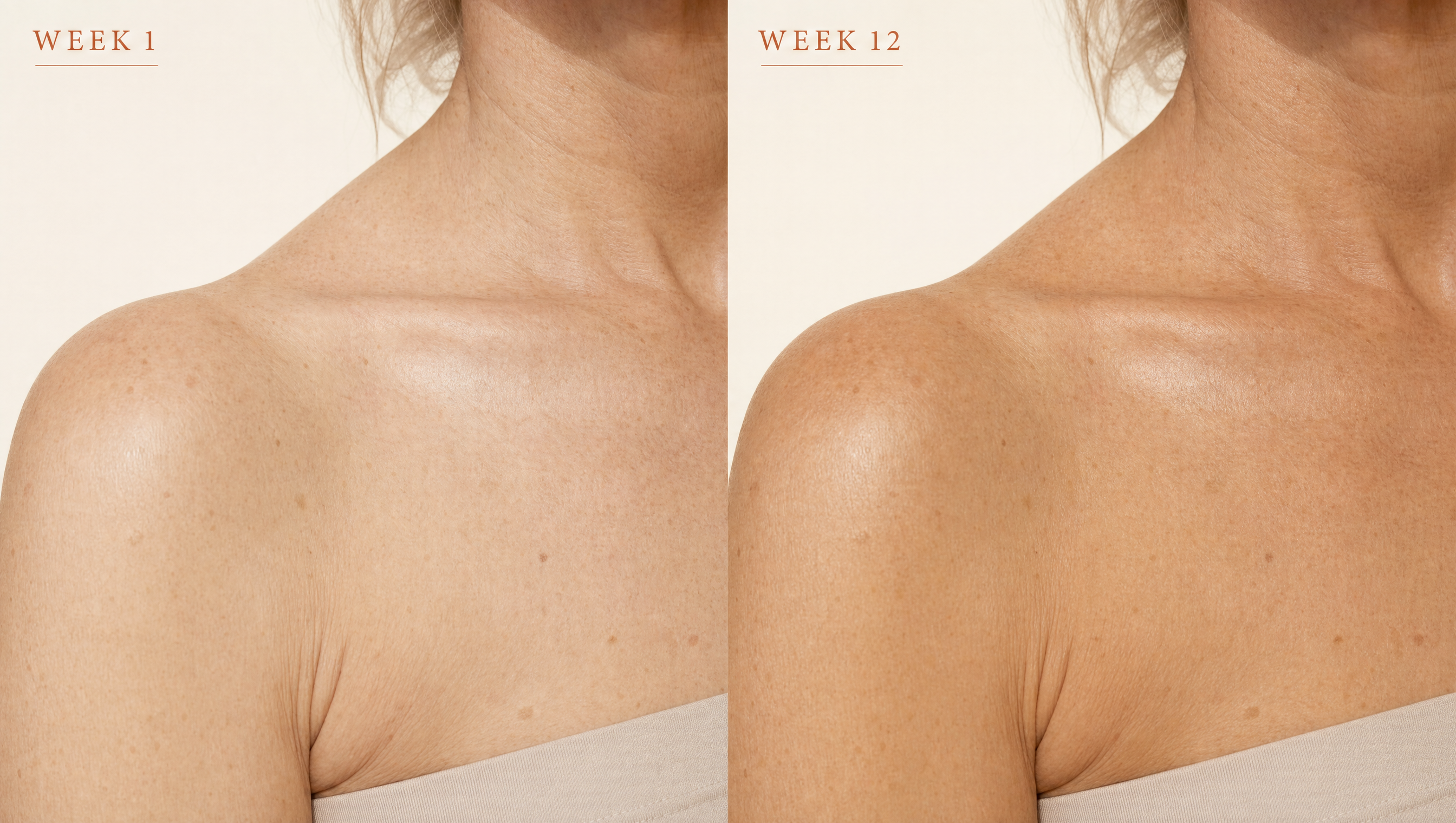 Bronzé tan progression — close-up Week 1 vs Week 12