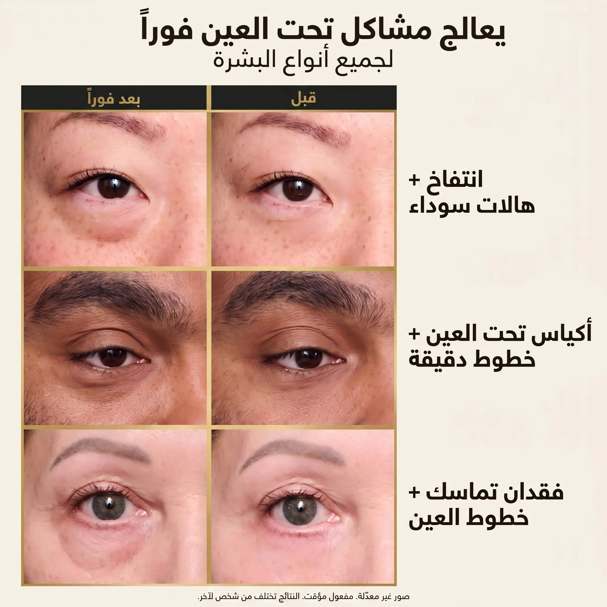 قبل وبعد - ثلاث تجارب لماسك العيون
