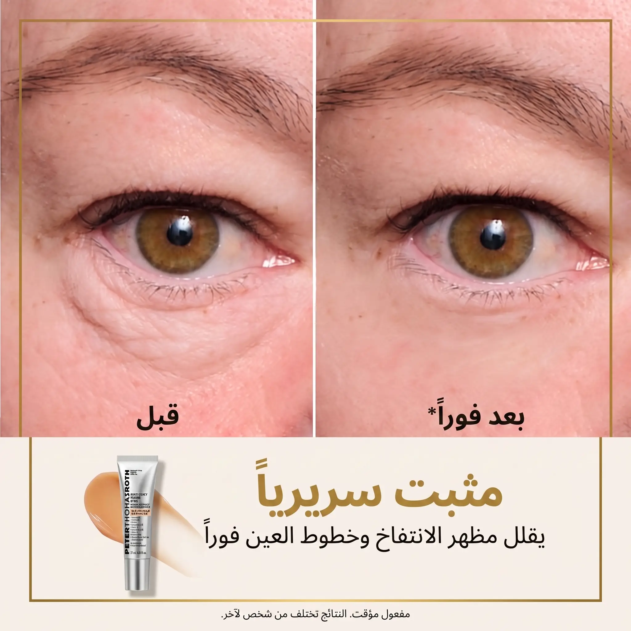 نتيجة قبل وبعد - الانتفاخ الصباحي