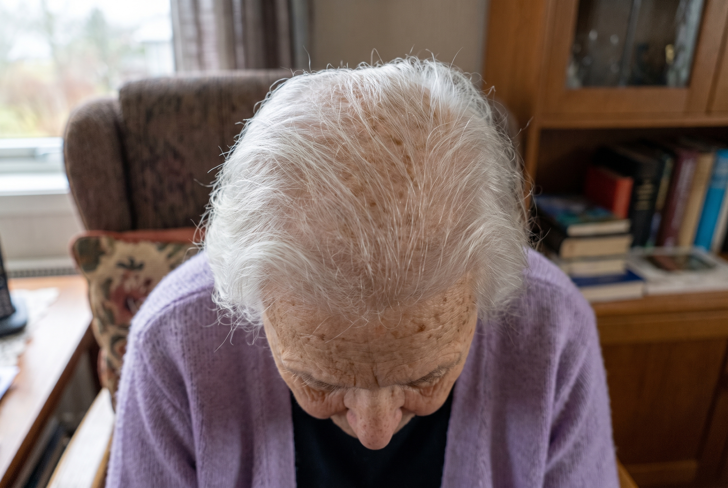 Randi, tettere hår ved isse etter noen måneders bruk