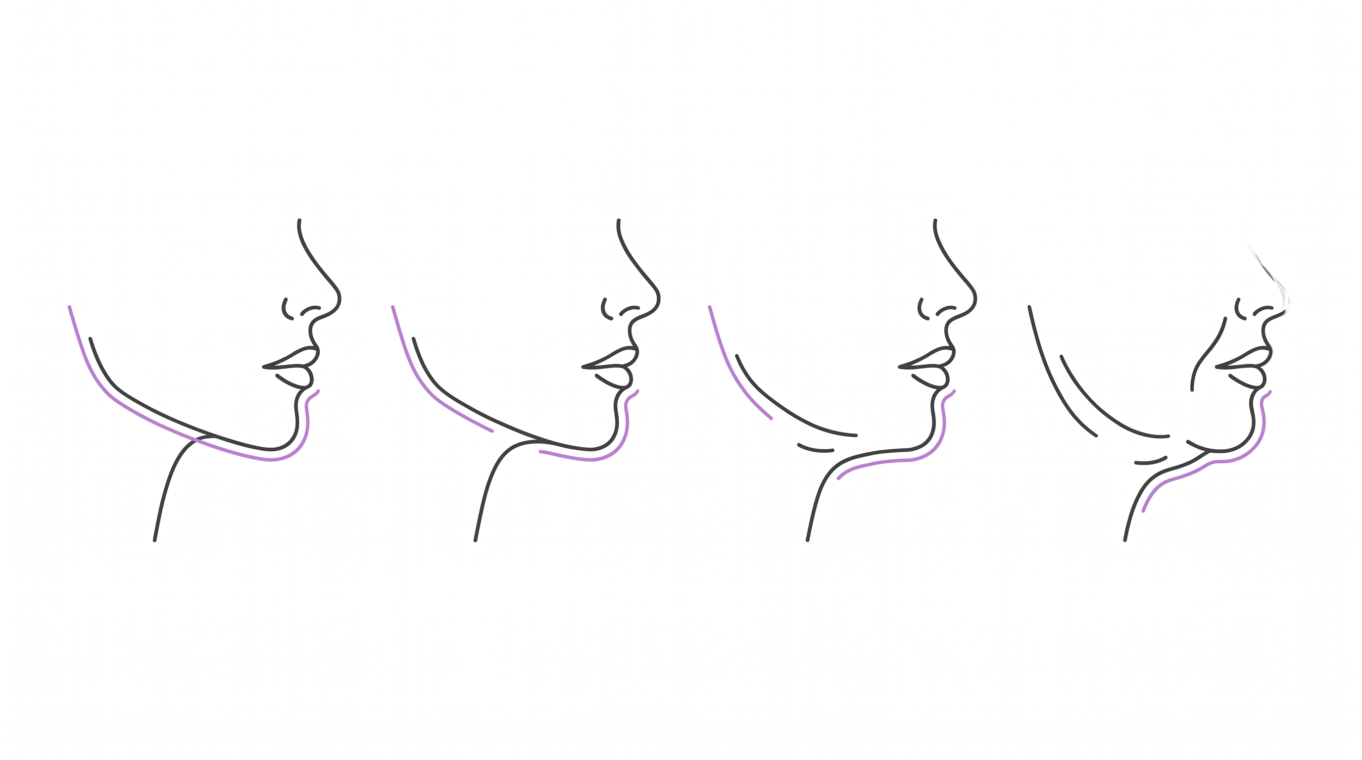 턱선이 또렷한 상태부터 턱선 아래 처짐과 목 피부 늘어짐까지 처짐 단계를 보여주는 옆얼굴 일러스트